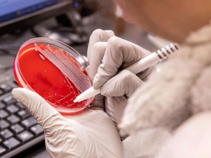 Unveiling Candida auris in Africa: Prevalence, Resistance, and Public Health Imperatives