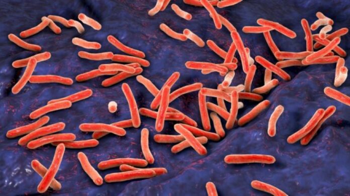 Revolutionizing TB Treatment: READ-TB Assay Enables Low-Cost, BSL-2 Monitoring with Acetic Acid