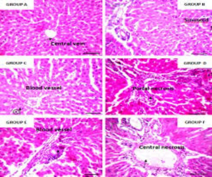 Therapeutic Potential of Justicia Carnea Leaf Extract in Diabetes Management: A Histopathological Study on Pancreas, Liver, and Kidneys