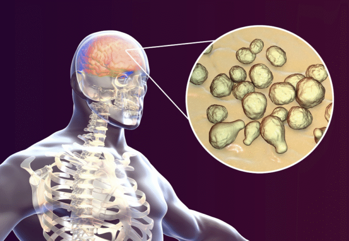 Recent ART Initiation Linked to Higher Mortality in HIV-Associated Cryptococcal Meningitis: Insights From African Clinical Trials Recent ART Initiation Linked to Higher Mortality in HIV-Associated Cryptococcal Meningitis: Insights From African Clinical Trials