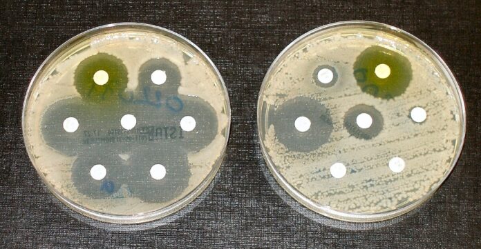 Rural South Africa Antibiotic Misuse: Patients’ Misunderstanding of Antibiotics and Antimicrobial Resistance (AMR) – Pilot Study Insights